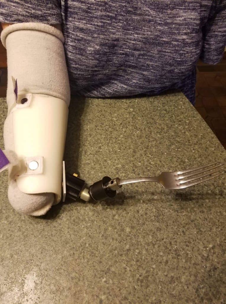 Amputee Life 5 Things This Quadruple Amputee Does Differently.