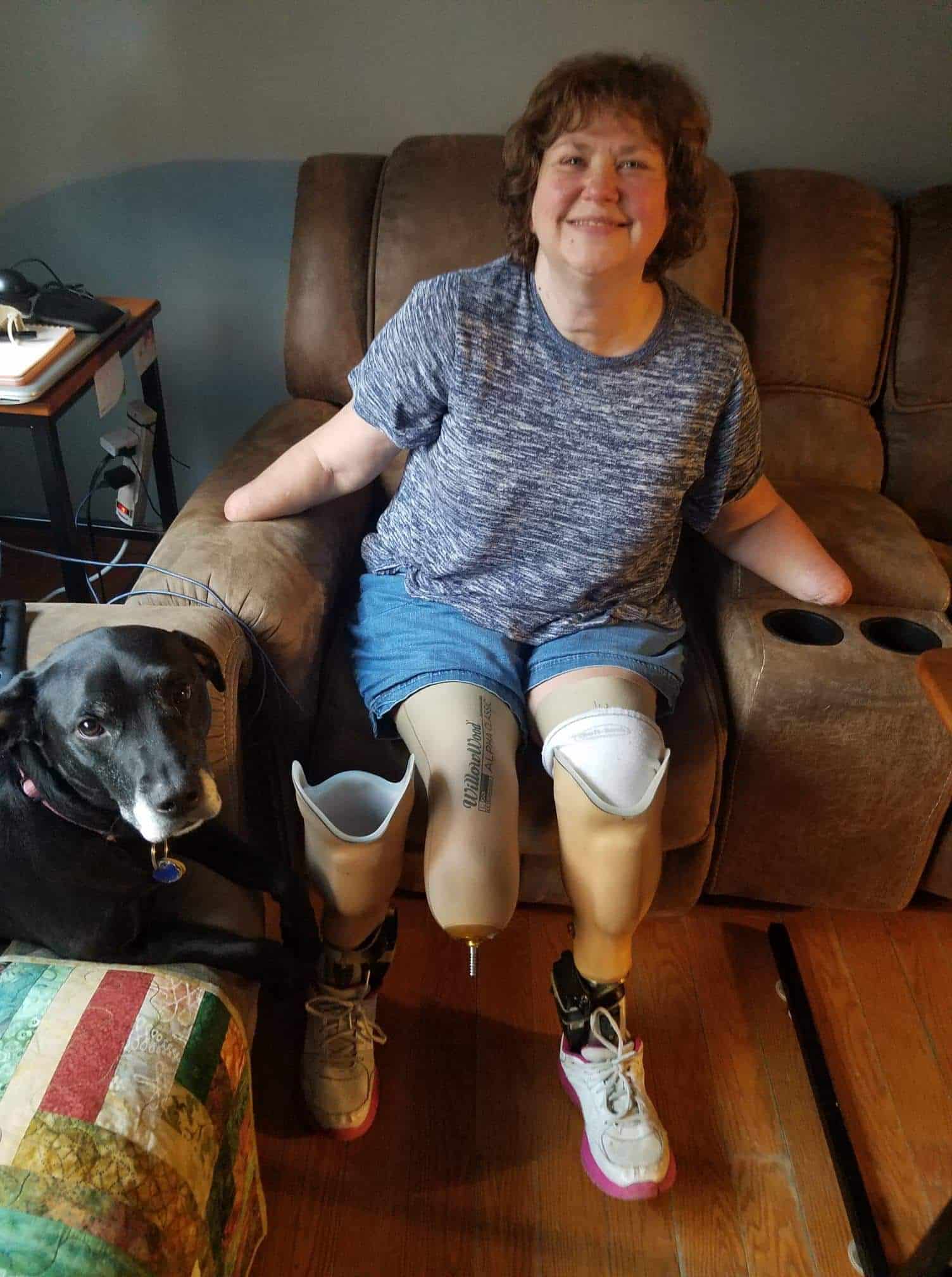 boston-marathon-victim-donates-prosthetic-leg-to-amputee