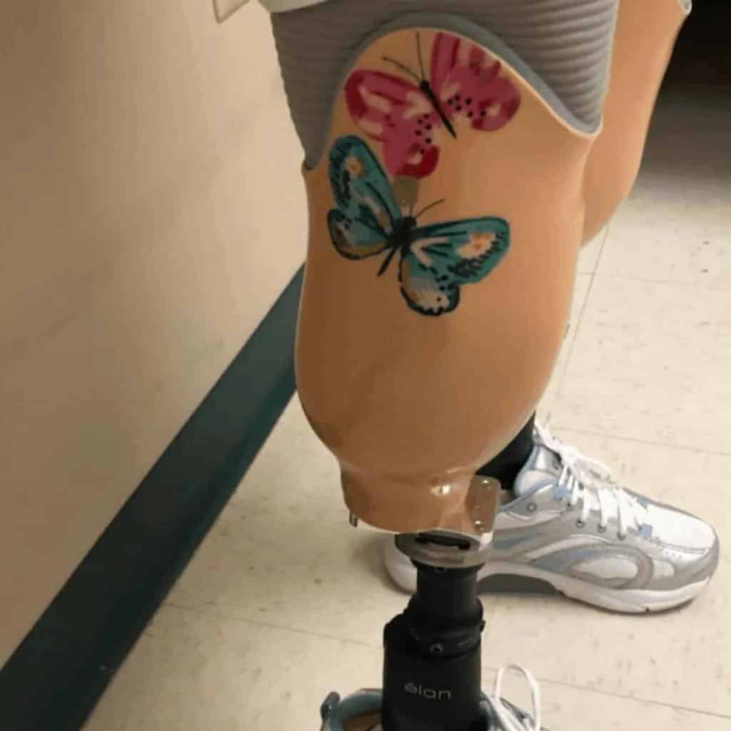 side view of prosthetic legs, butterfly tattoos