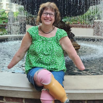 Start Here - One Exceptional Life 4 smiling browne haired woman, green polka dot top, quad amputee on fountain